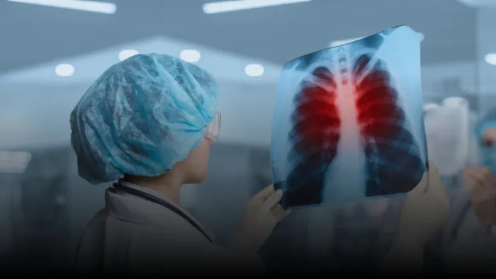 تخطيط كهربية القلب (EKG)